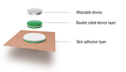 Structure of a Wearables Device.png